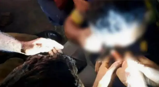 മീന്‍പിടിത്തത്തിനിടെ യുവാവിന്റെ കണ്ണില്‍ ചൂണ്ടക്കൊളുത്ത് കുടുങ്ങി