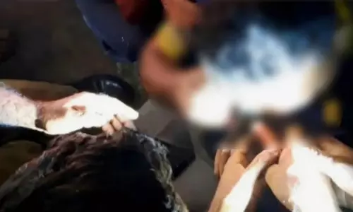 മീന്‍പിടിത്തത്തിനിടെ യുവാവിന്റെ കണ്ണില്‍ ചൂണ്ടക്കൊളുത്ത് കുടുങ്ങി