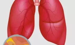 ആസ്മ വില്ലനാകുന്നോ? ; ആഗോളതലത്തില്‍, ആസ്മ കേസുകളില്‍ 13 ശതമാനവും ഇന്ത്യയില്‍