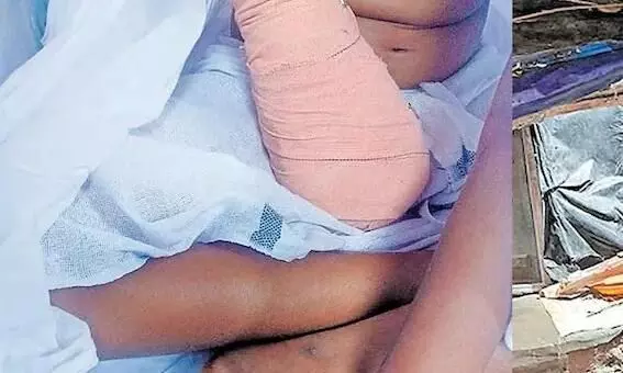 എന്റെ കൈ എവിടെയമ്മേ, മുറിച്ചു കളഞ്ഞോ?;ഒമ്പതു വയസ്സുകാരിയുടെ ചോദ്യത്തിന് മറുപടി പറയാനാവാതെ കുടുംബം എന്റെ കൈ എവിടെയമ്മേ, മുറിച്ചു കളഞ്ഞോ?;ഒമ്പതു വയസ്സുകാരിയുടെ ചോദ്യത്തിന് മറുപടി പറയാനാവാതെ കുടുംബം