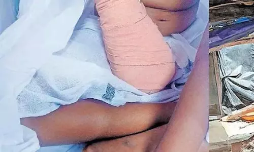 എന്റെ കൈ എവിടെയമ്മേ, മുറിച്ചു കളഞ്ഞോ?;ഒമ്പതു വയസ്സുകാരിയുടെ ചോദ്യത്തിന് മറുപടി പറയാനാവാതെ കുടുംബം