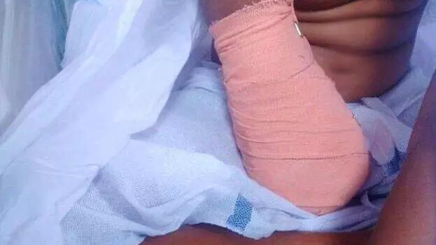 ചികിൽസാ പിഴവ് സംഭവിച്ചിട്ടില്ല; ഒമ്പതു വയസ്സുകാരിയുടെ കൈ മുറിച്ചു മാറ്റിയ സംഭവത്തിൽ അന്വേഷണ റിപോർട്ട് ചികിൽസാ പിഴവ് സംഭവിച്ചിട്ടില്ല; ഒമ്പതു വയസ്സുകാരിയുടെ കൈ മുറിച്ചു മാറ്റിയ സംഭവത്തിൽ അന്വേഷണ റിപോർട്ട്