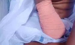 ചികിൽസാ പിഴവ് സംഭവിച്ചിട്ടില്ല; ഒമ്പതു വയസ്സുകാരിയുടെ കൈ മുറിച്ചു മാറ്റിയ സംഭവത്തിൽ അന്വേഷണ റിപോർട്ട് ചികിൽസാ പിഴവ് സംഭവിച്ചിട്ടില്ല; ഒമ്പതു വയസ്സുകാരിയുടെ കൈ മുറിച്ചു മാറ്റിയ സംഭവത്തിൽ അന്വേഷണ റിപോർട്ട്