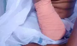 ഒമ്പതുകാരിയുടെ കൈ മുറിച്ചു മാറ്റിയ സംഭവം; രണ്ട് ഡോക്ടര്‍മാര്‍ക്ക് സസ്പെന്‍ഷന്‍