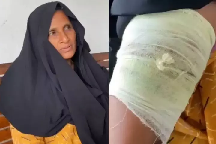 കാട്ടുപന്നി ശല്യത്തിനെതിരേ സമരം ചെയ്ത് വീട്ടിലെത്തിയ കര്‍ഷകയെ കാട്ടുപന്നി ആക്രമിച്ചു