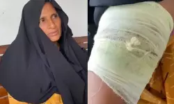 കാട്ടുപന്നി ശല്യത്തിനെതിരേ സമരം ചെയ്ത് വീട്ടിലെത്തിയ കര്‍ഷകയെ കാട്ടുപന്നി ആക്രമിച്ചു