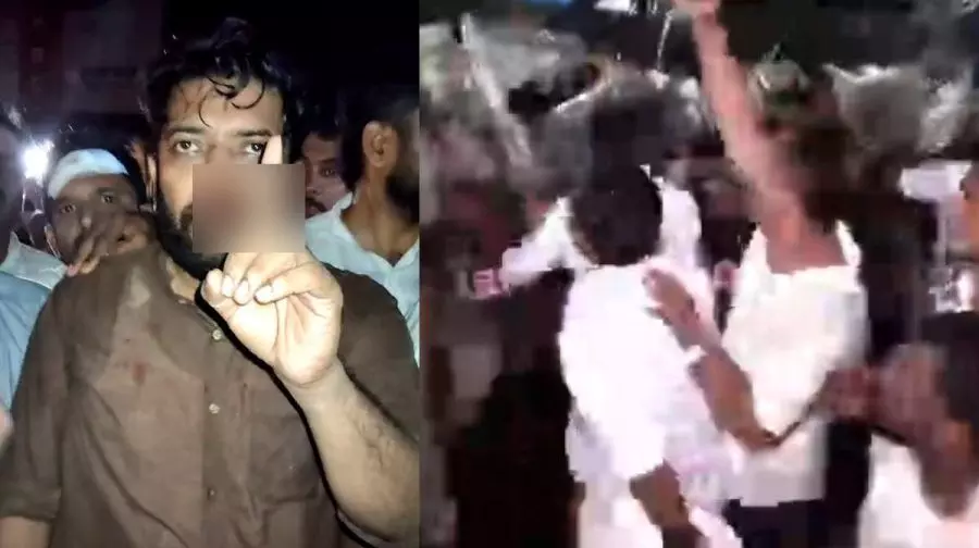 ഷാഫിയുടെ മൂക്കിന്റെ എല്ലിന് പൊട്ടല്, ,മുഖത്ത് ലാത്തി കൊണ്ട് ഇടിച്ചു; കോഴിക്കോട് ഡിസിസി പ്രസിഡന്റ് ഷാഫിയുടെ മൂക്കിന്റെ എല്ലിന് പൊട്ടല്, ,മുഖത്ത് ലാത്തി കൊണ്ട് ഇടിച്ചു; കോഴിക്കോട് ഡിസിസി പ്രസിഡന്റ്