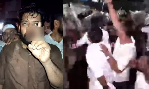 ഷാഫിയുടെ മൂക്കിന്റെ എല്ലിന് പൊട്ടല്‍, ,മുഖത്ത് ലാത്തി കൊണ്ട് ഇടിച്ചു; കോഴിക്കോട് ഡിസിസി പ്രസിഡന്റ്