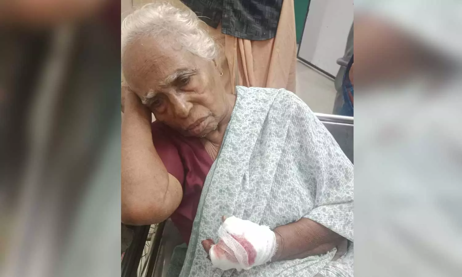 കൊല്ലത്ത് വയോധികയെ കാട്ടുപന്നി കടിച്ചു