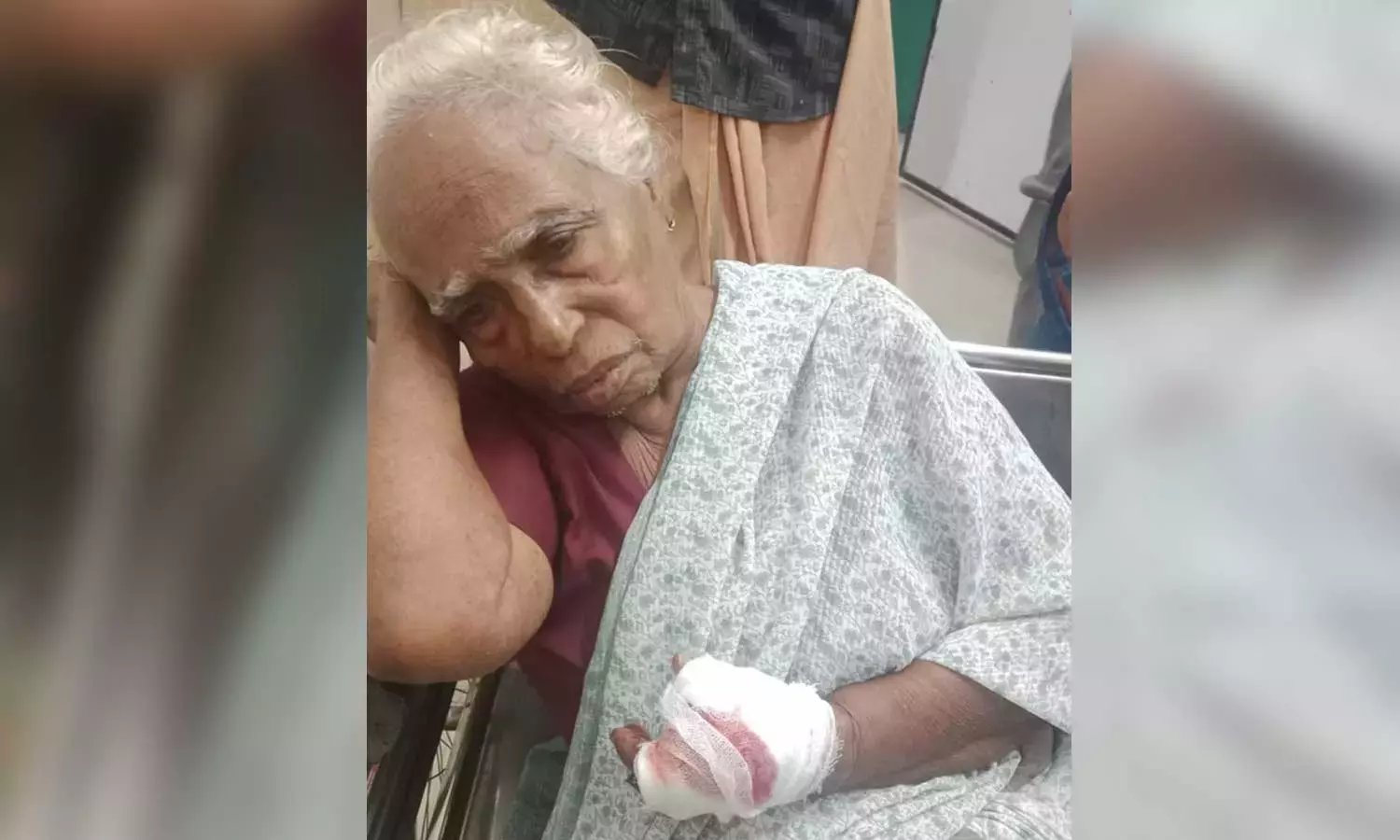 കൊല്ലത്ത് വയോധികയെ കാട്ടുപന്നി കടിച്ചു