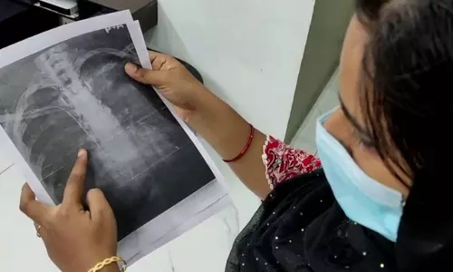 ഗൈഡ് വയര് കുടുങ്ങിയ സംഭവം; പ്രത്യേക മെഡിക്കല് ബോര്ഡ് രൂപീകരിക്കാന് ആവശ്യപ്പെട്ട് പോലിസ് ഡിഎംഓക്ക് കത്ത് നല്കി ഗൈഡ് വയര് കുടുങ്ങിയ സംഭവം; പ്രത്യേക മെഡിക്കല് ബോര്ഡ് രൂപീകരിക്കാന് ആവശ്യപ്പെട്ട് പോലിസ് ഡിഎംഓക്ക് കത്ത് നല്കി