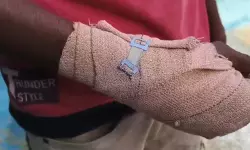 เดฆเดฒเดฟเดคเต เดฏเตเดตเดพเดตเดฟเดจเต เดเตเดฃเตเดเต เดทเต เดจเดเตเดเดฟเดเตเดเต; 12 เดฆเดฟเดตเดธเดคเตเดคเดฟเดจเต เดถเตเดทเด เดเตเดธเตเดเตเดคเตเดคเต เดชเตเดฒเดฟเดธเต เดฆเดฒเดฟเดคเต เดฏเตเดตเดพเดตเดฟเดจเต เดเตเดฃเตเดเต เดทเต เดจเดเตเดเดฟเดเตเดเต; 12 เดฆเดฟเดตเดธเดคเตเดคเดฟเดจเต เดถเตเดทเด เดเตเดธเตเดเตเดคเตเดคเต เดชเตเดฒเดฟเดธเต