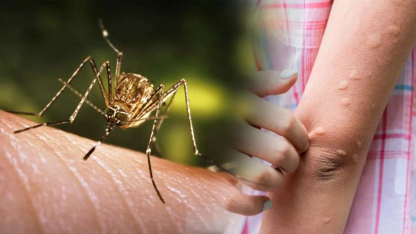 യുപിയില് ജാപ്പനീസ് എന്സെഫലൈറ്റിസ് (ജെഇ) പടര്ന്നുപിടിക്കുന്നു, റിപോര്ട്ട് യുപിയില് ജാപ്പനീസ് എന്സെഫലൈറ്റിസ് (ജെഇ) പടര്ന്നുപിടിക്കുന്നു, റിപോര്ട്ട്