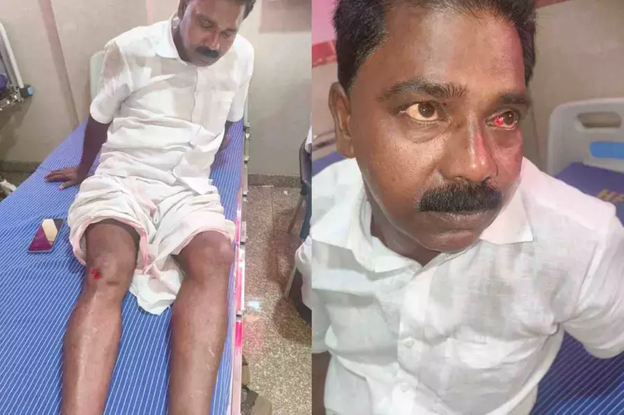 സഹകരണസംഘം തിരഞ്ഞെടുപ്പിനിടെ യുഡിഎഫ്-എല്‍ഡിഎഫ് സംഘര്‍ഷം