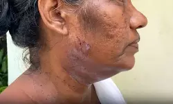 എസ്ഐആര് സര്വേക്കെത്തിയ ബിഎല്ഒയ്ക്ക് നേരെ നായയുടെ ആക്രമണം എസ്ഐആര് സര്വേക്കെത്തിയ ബിഎല്ഒയ്ക്ക് നേരെ നായയുടെ ആക്രമണം