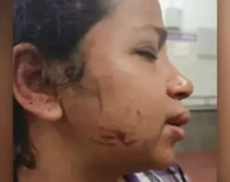 കോട്ടയത്ത് യുവതിയെ ഭര്ത്താവ് ക്രൂരമായി മര്ദ്ദിച്ചു, കൊല്ലുമെന്ന് ഭീഷണി കോട്ടയത്ത് യുവതിയെ ഭര്ത്താവ് ക്രൂരമായി മര്ദ്ദിച്ചു, കൊല്ലുമെന്ന് ഭീഷണി