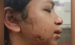 കോട്ടയത്ത് യുവതിയെ ഭര്‍ത്താവ് ക്രൂരമായി മര്‍ദ്ദിച്ചു, കൊല്ലുമെന്ന് ഭീഷണി