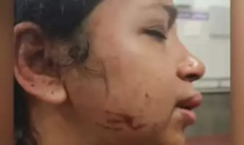 കോട്ടയത്ത് യുവതിയെ ഭര്‍ത്താവ് ക്രൂരമായി മര്‍ദ്ദിച്ചു, കൊല്ലുമെന്ന് ഭീഷണി