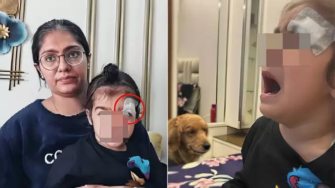 കുഞ്ഞിന്റെ മുറിവില്‍ തുന്നലിനു പകരം ഫെവിക്വിക്ക് പുരട്ടി ഡോക്ടര്‍