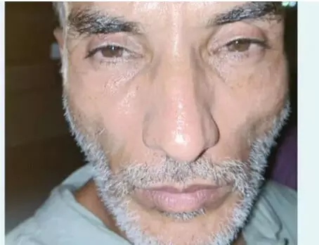 മോഷ്ടാവ് ബണ്ടി ചോര്‍ കസ്റ്റഡിയില്‍