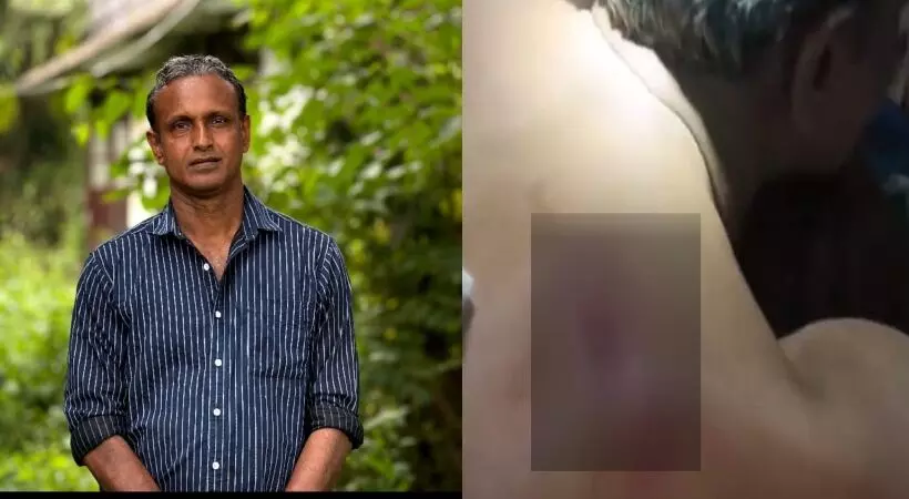 ചേന്ദമംഗലത്ത് സ്വതന്ത്ര സ്ഥാനാര്‍ഥിയ്ക്ക് കുത്തേറ്റു