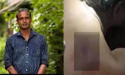 ചേന്ദമംഗലത്ത് സ്വതന്ത്ര സ്ഥാനാര്‍ഥിയ്ക്ക് കുത്തേറ്റു