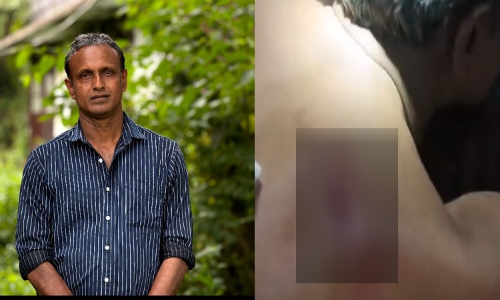 ചേന്ദമംഗലത്ത് സ്വതന്ത്ര സ്ഥാനാര്ഥിയ്ക്ക് കുത്തേറ്റു ചേന്ദമംഗലത്ത് സ്വതന്ത്ര സ്ഥാനാര്ഥിയ്ക്ക് കുത്തേറ്റു