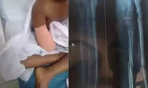 ഒന്പതു വയസ്സുകാരിയുടെ കൈ മുറിച്ച് മാറ്റിയ സംഭവം: കുടുംബം പരാതിയുമായി വികസന വകുപ്പിലേക്ക് ഒന്പതു വയസ്സുകാരിയുടെ കൈ മുറിച്ച് മാറ്റിയ സംഭവം: കുടുംബം പരാതിയുമായി വികസന വകുപ്പിലേക്ക്