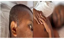 അട്ടപ്പാടിയില്‍ മോഷണക്കുറ്റം ആരോപിച്ച് ആദിവാസി യുവാവിനെ ക്രൂരമായി മര്‍ദ്ദിച്ചു