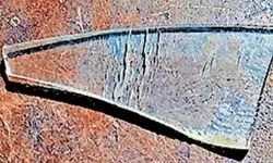 മെഡിക്കല് കോളജില് പ്ലാസ്റ്ററിട്ടയാളുടെ കാലില് ഫൈബര് ചില്ല് മെഡിക്കല് കോളജില് പ്ലാസ്റ്ററിട്ടയാളുടെ കാലില് ഫൈബര് ചില്ല്