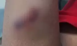 ക്ലാസില് പഠിപ്പിച്ചത് പൂര്ണമായി എഴുതിയെടുത്തില്ല; പ്ലസ് വണ് വിദ്യാര്ഥിയെ അധ്യാപകന് ക്രൂരമായി മര്ദിച്ചു ക്ലാസില് പഠിപ്പിച്ചത് പൂര്ണമായി എഴുതിയെടുത്തില്ല; പ്ലസ് വണ് വിദ്യാര്ഥിയെ അധ്യാപകന് ക്രൂരമായി മര്ദിച്ചു