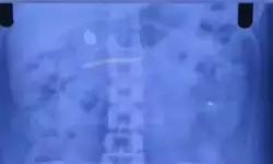 കുഞ്ഞിനെ ലാളിക്കുന്നതിനിടെ സ്വര്‍ണമാല മോഷ്ടിച്ച് വിഴുങ്ങി; യുവതി പിടിയില്‍