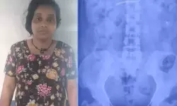 നിലമ്പൂര് മാല മോഷണം; തെളിവ് നശിപ്പിച്ച് പ്രതി, വിസര്ജ്യത്തിലൂടെ പുറത്തുവന്ന മാല ശൗചാലയത്തിലെ ക്ലോസറ്റിലിട്ടു നിലമ്പൂര് മാല മോഷണം; തെളിവ് നശിപ്പിച്ച് പ്രതി, വിസര്ജ്യത്തിലൂടെ പുറത്തുവന്ന മാല ശൗചാലയത്തിലെ ക്ലോസറ്റിലിട്ടു