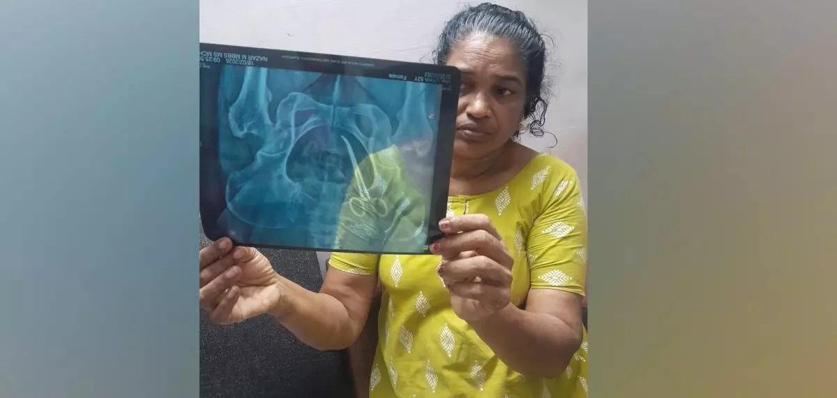 വണ്ടാനം മെഡിക്കല് കോളേജില് ചികില്സാ പിഴവ്; യുവതിയുടെ വയറ്റില് അഞ്ചു വര്ഷം മുന്പ് ശസ്ത്രക്രിയക്കിടെ കത്രിക മറന്നുവച്ചെന്ന് പരാതി വണ്ടാനം മെഡിക്കല് കോളേജില് ചികില്സാ പിഴവ്; യുവതിയുടെ വയറ്റില് അഞ്ചു വര്ഷം മുന്പ് ശസ്ത്രക്രിയക്കിടെ കത്രിക മറന്നുവച്ചെന്ന് പരാതി