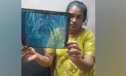 വണ്ടാനം മെഡിക്കല് കോളേജില് ചികില്സാ പിഴവ്; യുവതിയുടെ വയറ്റില് അഞ്ചു വര്ഷം മുന്പ് ശസ്ത്രക്രിയക്കിടെ കത്രിക മറന്നുവച്ചെന്ന് പരാതി വണ്ടാനം മെഡിക്കല് കോളേജില് ചികില്സാ പിഴവ്; യുവതിയുടെ വയറ്റില് അഞ്ചു വര്ഷം മുന്പ് ശസ്ത്രക്രിയക്കിടെ കത്രിക മറന്നുവച്ചെന്ന് പരാതി