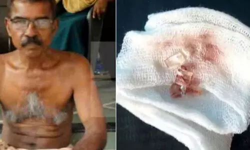 കൈയ്യിലെ ചില്ല് നീക്കാതെ മുറിവ് തുന്നികെട്ടി; ചേര്ത്തല താലൂക്ക് ആശുപത്രിക്കെതിരേ പരാതി കൈയ്യിലെ ചില്ല് നീക്കാതെ മുറിവ് തുന്നികെട്ടി; ചേര്ത്തല താലൂക്ക് ആശുപത്രിക്കെതിരേ പരാതി