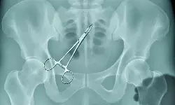 ഉഷയുടേതല്ല, പിണറായി സര്‍ക്കാരിന്റെ എക്സറേയാണിതെന്ന് ഷാഫി പറമ്പില്‍