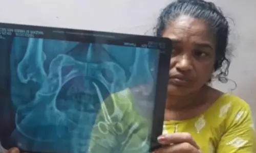 വണ്ടാനം മെഡിക്കല്‍ കോളേജിലെ ചികില്‍സാ പിഴവ്; ഉഷാ ജോസഫിന്റെ ശസ്ത്രക്രിയ നാളെ നടക്കും