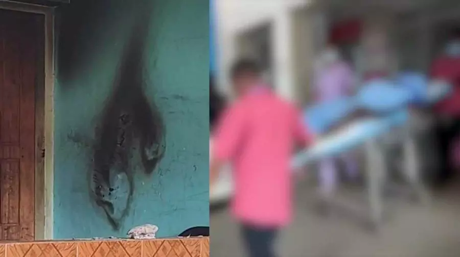 മോഷണക്കേസില് ഭാര്യ പിടിയിലായി; യുവാവ് തീ കൊളുത്തി ജീവനൊടുക്കാന് ശ്രമിച്ചു മോഷണക്കേസില് ഭാര്യ പിടിയിലായി; യുവാവ് തീ കൊളുത്തി ജീവനൊടുക്കാന് ശ്രമിച്ചു