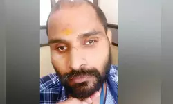 ചികില്‍സാ പിഴവില്‍ കാഴ്ച്ച നഷ്ടപ്പെട്ടെന്ന് ആരോപിക്കുന്ന സനൂപിന് കൃത്രിമക്കണ്ണുകള്‍ വച്ചു