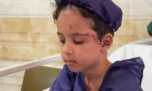 മിസൈല്‍ വന്നു പതിക്കുന്നത് നിഷ്‌കളങ്കരായ കുരുന്നുകള്‍ക്കുമേല്‍, ഇറാനില്‍ നിന്നു വേദനിപ്പിക്കുന്ന ചിത്രങ്ങള്‍