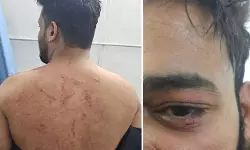 ഇഫ്താറിനെത്തിയവരെ ആക്രമിച്ച് ഹിന്ദുത്വര്‍; 11 പേര്‍ക്ക് പരിക്ക്