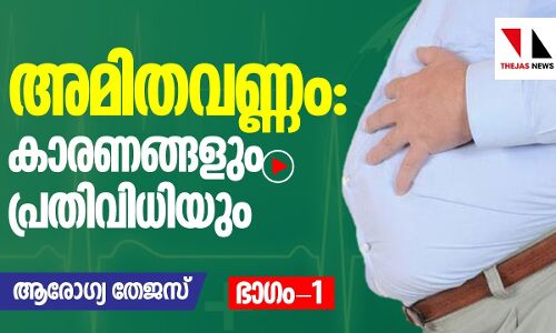 അമിതവണ്ണം: കാരണങ്ങളും പ്രതിവിധിയും: ഭാഗം-1